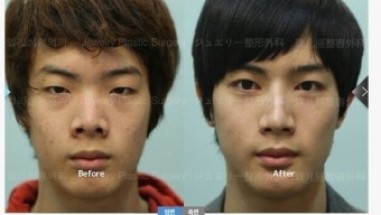 성형상담